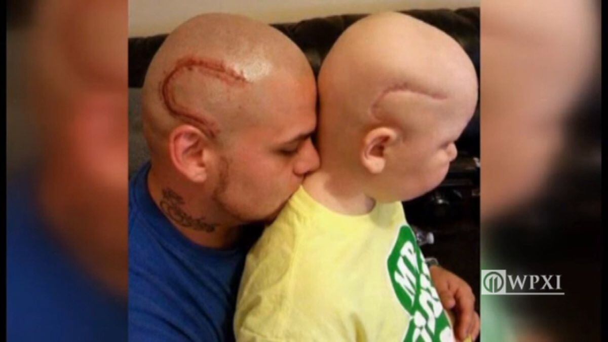 Brain cancer returns for child of dad who tattooed ...